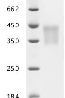 Mouse Hypoxia-inducible factor 1-alpha (Hif1a), partial Recombinant Protein, C-10His - BioCrest Sci