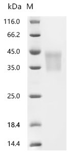 Mouse Hypoxia-inducible factor 1-alpha (Hif1a), partial Recombinant Protein, C-10His, Mus musculus (Mouse), Mammalian cell, C-terminal 10xHis-tagged, 24.5 kDa, purity >≥ 95% as determined by SDS-PAGE.