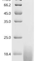 Human Ly-6/neurotoxin-like protein 1 (LYNX1), partial Recombinant Protein - BioCrest Sci