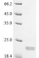 Mouse Interleukin-18 (Il18) (N36H,M85A,K87G,E90R,V91A,L94K) Recombinant Protein - BioCrest Sci