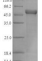 Escherichia coli CFA/I fimbrial subunit E (cfaE) Recombinant Protein, N-His-SUMO - BioCrest Sci