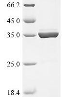 Rhizobium meliloti Nodulation protein H (nodH) Recombinant Protein - BioCrest Sci