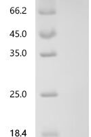 Human Netrin receptor DCC (DCC), partial Recombinant Protein - BioCrest Sci