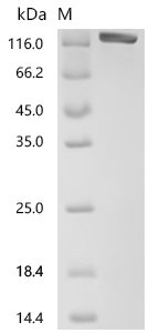 Human Netrin receptor DCC (DCC), partial Recombinant Protein, Homo sapiens (Human), Mammalian cell, C-terminal hFc1-tagged, 145.8 kDa, purity >≥ 95% as determined by SDS-PAGE.