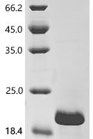 Human Transcription factor SOX-4 (SOX4), partial Recombinant Protein - BioCrest Sci