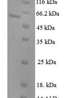 Mouse Pituitary homeobox 3 (Pitx3) Recombinant Protein, N-GST - BioCrest Sci