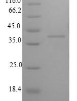 Rat Insulin-like growth factor-binding protein 1 (Igfbp1) Recombinant Protein, N-His-SUMO - BioCrest Sci