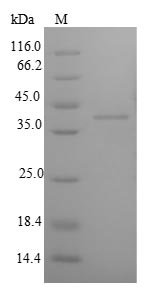 Rat Insulin-like growth factor-binding protein 1 (Igfbp1) Recombinant Protein, N-His-SUMO, Rattus norvegicus (Rat), E.coli, N-terminal 6xHis-SUMO-tagged, 42.9 kDa, purity >≥ 90% as determined by SDS-PAGE.