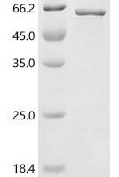 Streptococcus mutans serotype c UDP-N-acetylmuramoyl-L-alanyl-D-glutamate--L-lysine ligase (murE) Recombinant Protein - BioCrest Sci