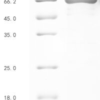 Human Dihydropyrimidinase-related protein 4 (DPYSL4), partial Recombinant Protein - BioCrest Sci