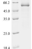 Human Bactericidal permeability-increasing protein (BPI) Recombinant Protein, C-His - BioCrest Sci