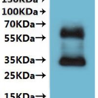 Human Somatostatin receptor type 4 (SSTR4)-VLPs Recombinant Protein - BioCrest Sci