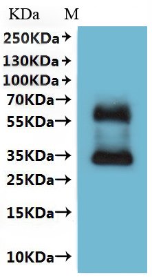 Human Somatostatin receptor type 4 (SSTR4)-VLPs Recombinant Protein, Homo sapiens (Human), Mammalian cell, C-terminal 10xHis-tagged(This tag can be tested only under denaturing conditions), 43.4 kDa, purity >The purity information is not available for VLPs proteins.