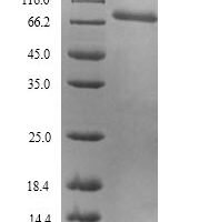 Mouse Inactive tyrosine-protein kinase 7 (Ptk7), partial Recombinant Protein - BioCrest Sci