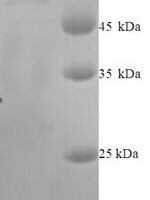 Human Indoleamine 2,3-dioxygenase 2 (IDO2) Recombinant Protein, N-His - BioCrest Sci
