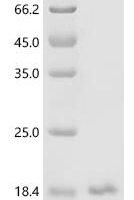 Human Insulin (INS) Recombinant Protein - BioCrest Sci