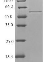 Human Tropomyosin alpha-4 chain (TPM4) Recombinant Protein - BioCrest Sci