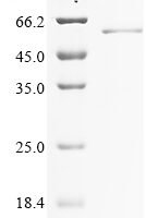 Mouse Olfactomedin-4 (Olfm4) Recombinant Protein - BioCrest Sci