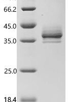Human Annexin A1 (ANXA1) Recombinant Protein, C-10His - BioCrest Sci