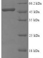 Human 39S ribosomal protein L1, mitochondrial (MRPL1), partial Recombinant Protein - BioCrest Sci