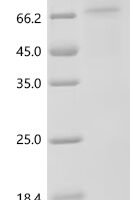 HumanProtein-arginine deiminase type-4 (PADI4) Recombinant Protein - BioCrest Sci