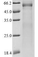 Avian infectious bronchitis virus Nucleoprotein (N) Recombinant Protein, C-His, aa 1–409, strain KB8523, Mammalian cell - BioCrest Sci