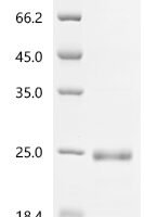 Aspidelaps scutatus Cytotoxin homolog S3C2 Recombinant Protein, N-His-SUMO - BioCrest Sci
