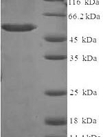 Human Aldo-keto reductase family 1 member C2 (AKR1C2) Recombinant Protein - BioCrest Sci