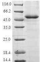 Human Anaphase-promoting complex subunit 10 (ANAPC10) Recombinant Protein - BioCrest Sci