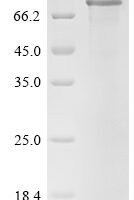 Human Delta and Notch-like epidermal growth factor-related receptor (DNER), partial Recombinant Protein, N-10His/C-Myc - BioCrest Sci