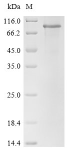Human Delta and Notch-like epidermal growth factor-related receptor (DNER), partial Recombinant Protein, N-10His/C-Myc, Homo sapiens (Human), E.coli, N-terminal 10xHis-tagged and C-terminal Myc-tagged, 71.6 kDa, purity >≥ 85% as determined by SDS-PAGE.