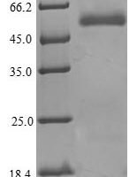 Human Phospholipid transfer protein (PLTP) Recombinant Protein, N-His - BioCrest Sci