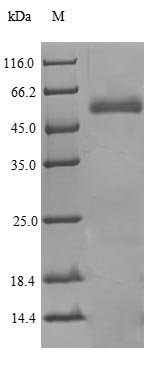 Human Phospholipid transfer protein (PLTP) Recombinant Protein, N-His, Homo sapiens (Human), Yeast, N-terminal 6xHis-tagged, 49.6 kDa, purity >≥ 90% as determined by SDS-PAGE.