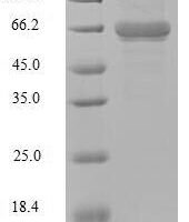Human ATP-dependent RNA helicase A (DHX9), partial Recombinant Protein, C-Flag-Myc - BioCrest Sci