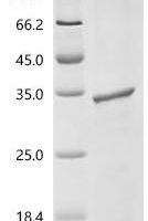 Human Acetylcholine receptor subunit epsilon (CHRNE), partial Recombinant Protein, N-His - BioCrest Sci