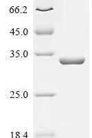 Bacillus cereus Metallo-beta-lactamase type 2 (blm) Recombinant Protein - BioCrest Sci
