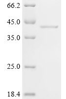 Mouse Deoxyribonuclease gamma (Dnase1l3) Recombinant Protein - BioCrest Sci