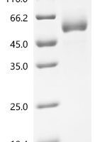 Parabacteroides distasonis Outer membrane protein beta-barrel domain-containing protein Recombinant Protein - BioCrest Sci