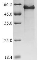 Mouse Protein Wnt-7b (Wnt7b) Recombinant Protein, N-IFNT1/C-His - BioCrest Sci