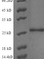 Human Endothelial protein C receptor (PROCR), partial Recombinant Protein - BioCrest Sci