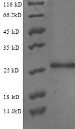 Human Endothelial protein C receptor (PROCR), partial Recombinant Protein, Homo sapiens (Human), E.coli, N-terminal 6xHis-tagged, 26.0 kDa, purity >≥ 90% as determined by SDS-PAGE.