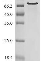 Mycoplasma pneumoniae Proline-rich P65 protein (p65) Recombinant Protein - BioCrest Sci
