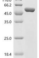 Pig Natriuretic peptides A (NPPA), partial, Biotinylated Recombinant Protein - BioCrest Sci