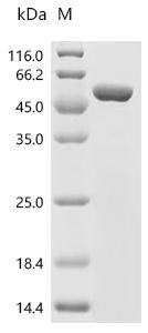 Pig Natriuretic peptides A (NPPA), partial, Biotinylated Recombinant Protein, Sus scrofa (Pig), E.coli, N-terminal MBP-tagged and C-terminal 6xHis-Avi-tagged, 50.8 kDa, purity >≥ 90% as determined by SDS-PAGE.