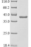 Human ATP synthase F(1) complex subunit gamma, mitochondrial (ATP5F1C) Recombinant Protein - BioCrest Sci