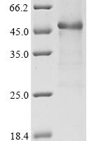 Human Interleukin-2 receptor subunit alpha (IL2RA), partial Recombinant Protein - BioCrest Sci