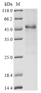 Human Interleukin-2 receptor subunit alpha (IL2RA), partial Recombinant Protein, Homo sapiens (Human), E.coli, N-terminal 6xHis-GST-tagged, 50.3 kDa, purity >≥ 85% as determined by SDS-PAGE.