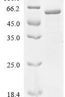 Human Protein FAM234A (FAM234A), partial Recombinant Protein - BioCrest Sci