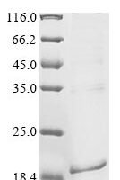 Rat Parathyroid hormone (Pth) Recombinant Protein - BioCrest Sci