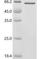 Mouse Phosphatidylinositol 3,4,5-trisphosphate 3-phosphatase and dual-specificity protein phosphatase PTEN (Pten) Recombinant Protein - BioCrest Sci